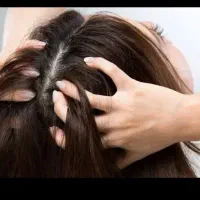 پاکسازی شپش و رشک کاملا تضمینی یکبار امتحان کافیه