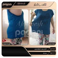 درمان لاغری آسان مثل کوره چربی بسوزنید|آرایشی، بهداشتی، درمانی|گنبد کاووس, |دیوار