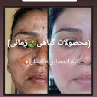 کرم چند کاره درخشان کاملا انحصاری و بدون بازگشت