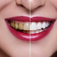 دندانپزشکی ایمپلنت کامپوزیت|خدمات آرایشگری و زیبایی|تهران, صادقیه|دیوار