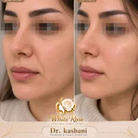 کلینیک زیبایی رز سفید 30 % off تابستانه