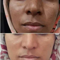 امارتی|آرایشی، بهداشتی، درمانی|داراب, |دیوار