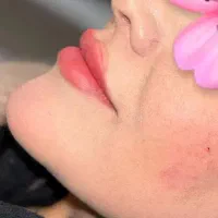 مرکز تخصصی ژل بوتاکس /کاشت امبدینگ لاغری در مطب|خدمات آرایشگری و زیبایی|کرمانشاه, |دیوار