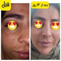 رشد مجدد موها فقط با محصولات طبیعی