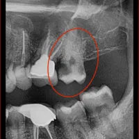 دندانپزشکی دنتال استار|خدمات آرایشگری و زیبایی|تهران, مینای جنوبی|دیوار