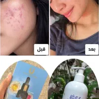 تنها نمایندگی سرم مغذی (همه کاره) لاکچری کوین|حراج|مشهد, فردوسی|دیوار