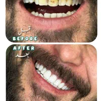 خدمات درمانی دندان پزشکی|خدمات آرایشگری و زیبایی|قم, چهار مردان|دیوار