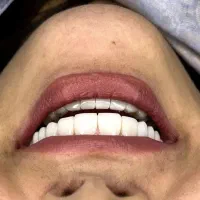 تخفیف کامپوزیت لمینت با اقساط|خدمات آرایشگری و زیبایی|قم, مهدیه|دیوار