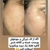 کرم و صابون ویکتوریا ضدلک صددرصد تضمینی|آرایشی، بهداشتی، درمانی|نیشابور, جمهوری|دیوار