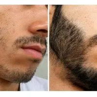 حسرت خوردن نداره اقدام کن نتیجه شو ببین