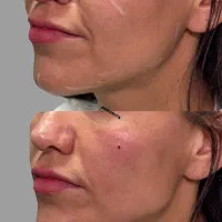 جشنواره ویژه ژل لب،کانتورینگ صورت|خدمات آرایشگری و زیبایی|تهران, شهرک غرب|دیوار