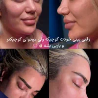 اف آخر سال عمل زیبایی ۱۹ میلیون