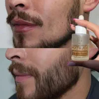 محلول. رویش.ریش.سبیل .۲۶ روزه