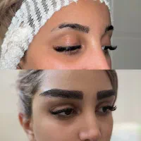 میکروکاشت تخصصی ابرو نقد و اقساط