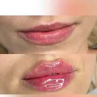 اموزش و خدمات ژل و بوتاکس با چک|خدمات آرایشگری و زیبایی|کرمان, |دیوار