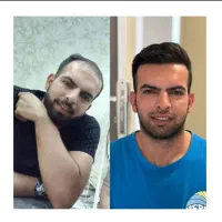 کاشت مو و  ابرو شیرازی در اصفهان|خدمات آرایشگری و زیبایی|لردگان, |دیوار