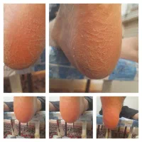 اسپا وی ای پی تضمینی ۳۰۰ هزارتومان|خدمات آرایشگری و زیبایی|شیراز, شهرک ولیعصر|دیوار