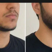 میخوای ریشات در بیاد