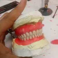 ساخت انواع دندان مصنوعی با نازل ترین قیمت