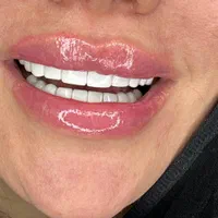 خدمات دندانپزشکی|خدمات آرایشگری و زیبایی|کرج, حصارک بالا|دیوار