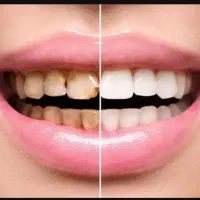 دندانپزشکی اقساطی|خدمات آرایشگری و زیبایی|قم, پردیسان|دیوار