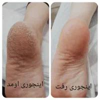 تخفیف ویژه روز مادرو یلدا فشیال دست وپاو صورت|خدمات آرایشگری و زیبایی|اصفهان, گرکان|دیوار