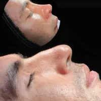 جشنواره جراحی و عمل بینی در کرج|خدمات آرایشگری و زیبایی|چهارباغ, |دیوار