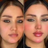 ژل لب(فیلر لب روسی)|خدمات آرایشگری و زیبایی|اسلامشهر, شهرک قائمیه|دیوار