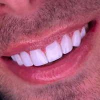 دندانپزشکی و ایمپلنت و کامپوزیت و ارتودنسی|خدمات آرایشگری و زیبایی|سرپل ذهاب, |دیوار