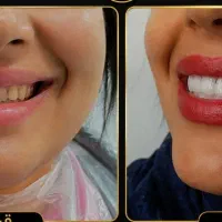 بزرگترین جشنواره سال دندانپزشکی،درمانگاه خاورمیانه|خدمات زیبایی و سلامت|شیراز, عفیفآباد|دیوار