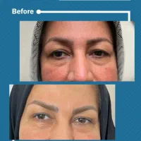 سرم و آمپول و حجامت در منزل|خدمات آرایشگری و زیبایی|گلبهار, شهر جدید گلبهار|دیوار