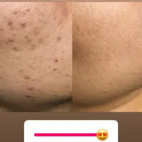 فیشال و خدمات تخصصی پوست توسط پیراپزشک در مطب پزشک|خدمات آرایشگری و زیبایی|مشهد, سجاد شهر|دیوار