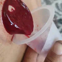 حجامت|خدمات آرایشگری و زیبایی|زاهدان, |دیوار