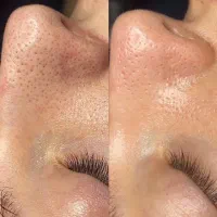 پاکسازی(فیشال) صورت،پدیکور و کفسابی پا برای خانم ا