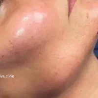 جشنواره خدمات زیبایی به مدت محدود|خدمات آرایشگری و زیبایی|شیراز, آبیاری|دیوار