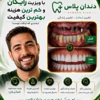 ایمپلنت کره ای 16/900 اقساط 12ماهه بدون پیش پرداخت