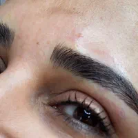 میکروبلیدینگ(موربروز)