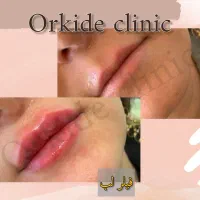 جم ، اُرکیده / کلینیک لاغری، لیزر و زیبایی