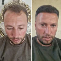 کلینیک تخصصی پوست، مو و زیبایی پارسامهر|خدمات آرایشگری و زیبایی|تهران, امیریه|دیوار