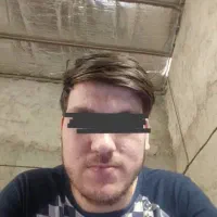 برداشتن انواع زگیل، خال و لک پوستی،فیشیال در منزل|خدمات آرایشگری و زیبایی|تهران, ظفر|دیوار