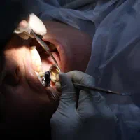 استخدام دستیار دندانپزشک / آبپخش