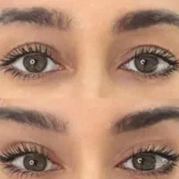 جشنواره لیفت ابرو و شقیقه با نخ با بوتاکس رایگان