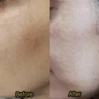 خدمات زیبایی دکتر سجاد جلیلی فرد|خدمات آرایشگری و زیبایی|مسجد سلیمان, |دیوار