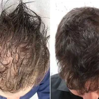 این یه رازه پرپشتی موهاته