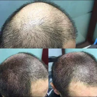 تاتو بدن|خدمات آرایشگری و زیبایی|پرند, فاز ۶|دیوار