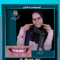 جشنواره ایمپلنت دندانپزشکی مرکز تخصصی دندان شیراز