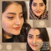 جراحی بینی بدون تامپون با ۲۵ سال سابقه|خدمات آرایشگری و زیبایی|کرج, مهرویلا جنوبی|دیوار