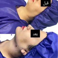ساکشنغبغب
