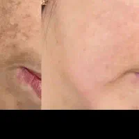 کرم سفید کننده صورت و بدن تضمینی