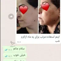 کرم ضدلک قوی معجزه